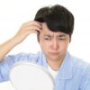額を見てハゲが気になる男性