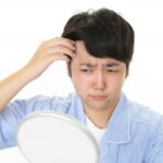 額を見てハゲが気になる男性